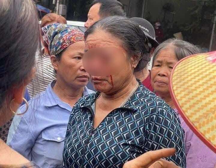 Hình ảnh thời điểm xảy ra xô xát. Ảnh: MXH