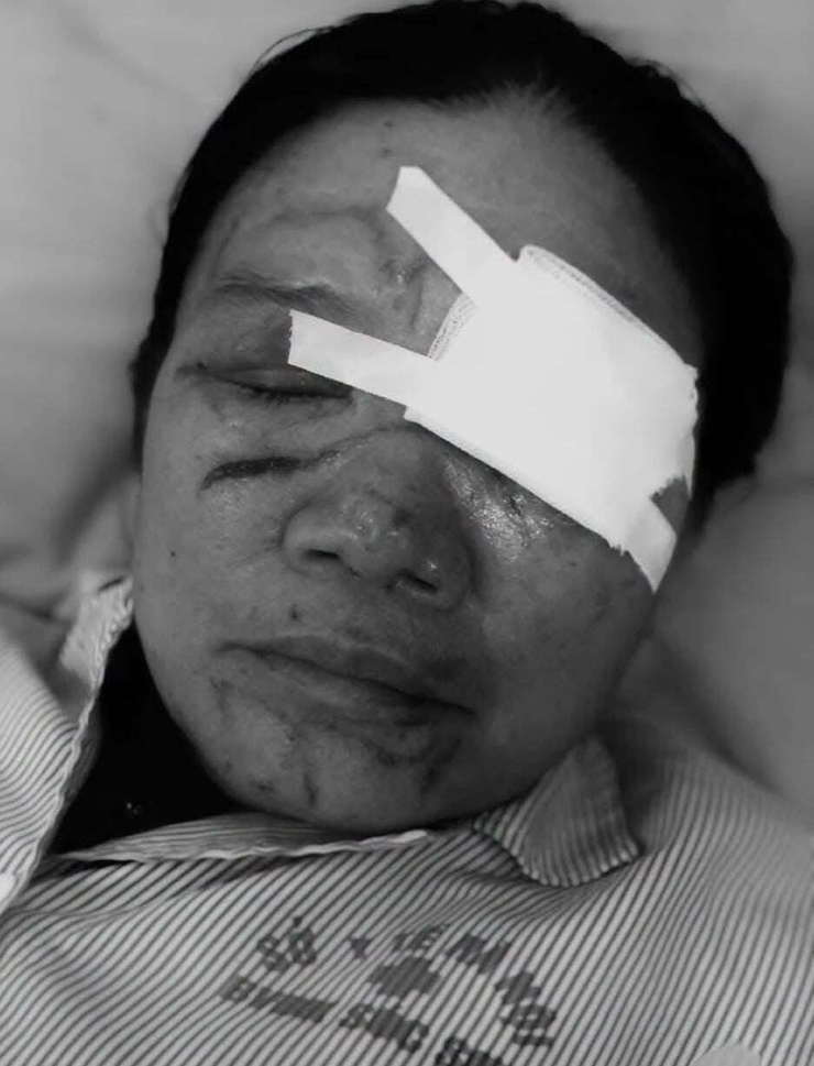 Bệnh nhân đang được điều trị, theo dõi tại Bệnh viện Sóc Sơn (Hà Nội). Ảnh: GĐCC