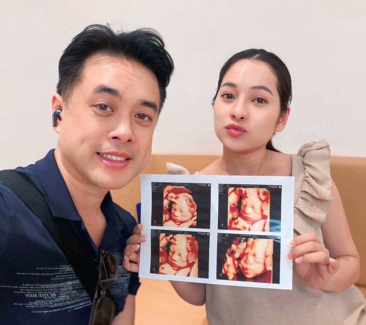 Ảnh sao 10/7: Kim Tuyến thức đợi Đồng Ánh Quỳnh đi làm về muộn - 7