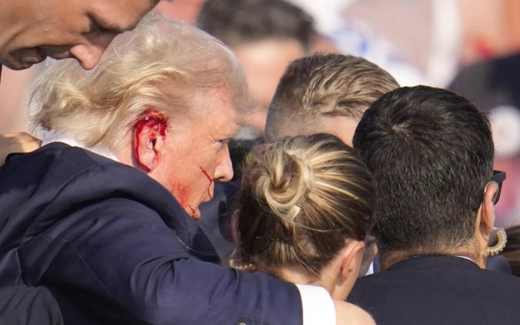 Ông Trump bị thương trong vụ ám sát nhằm vào ông hồi tháng 7/2024. Ảnh: AP.