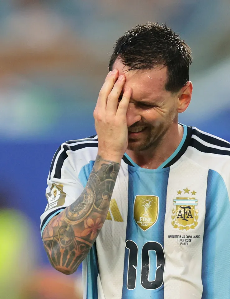 Trán của Messi nổi cục u nhưng anh vẫn đá tiếp