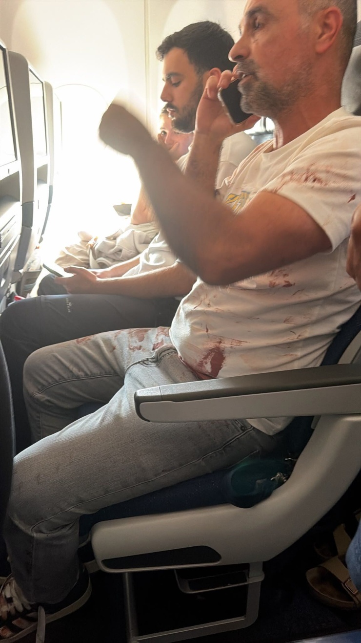 Áo của hành khách trên chuyến bay flydubai bị dính máu sau sự cố ngày 30/9. Ảnh: X/Amichai Stein
